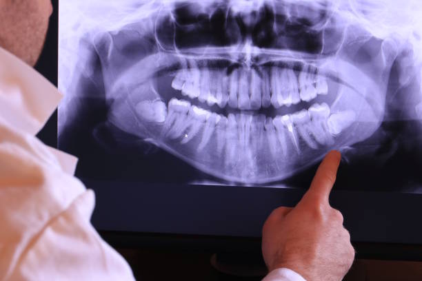 Best Emergency Tooth Extraction in National Harbor, MD