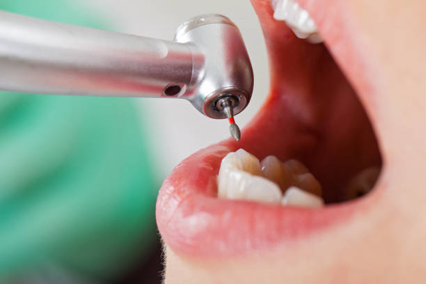 Best Cosmetic Emergency Dentistry in National Harbor, MD
